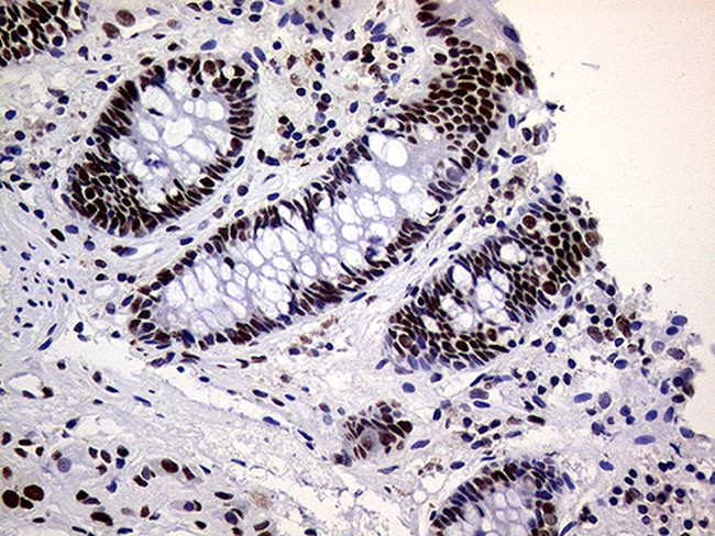 RING1 Antibody in Immunohistochemistry (Paraffin) (IHC (P))