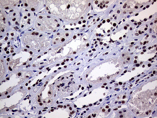 RING1 Antibody in Immunohistochemistry (Paraffin) (IHC (P))