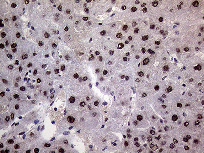 RING1 Antibody in Immunohistochemistry (Paraffin) (IHC (P))