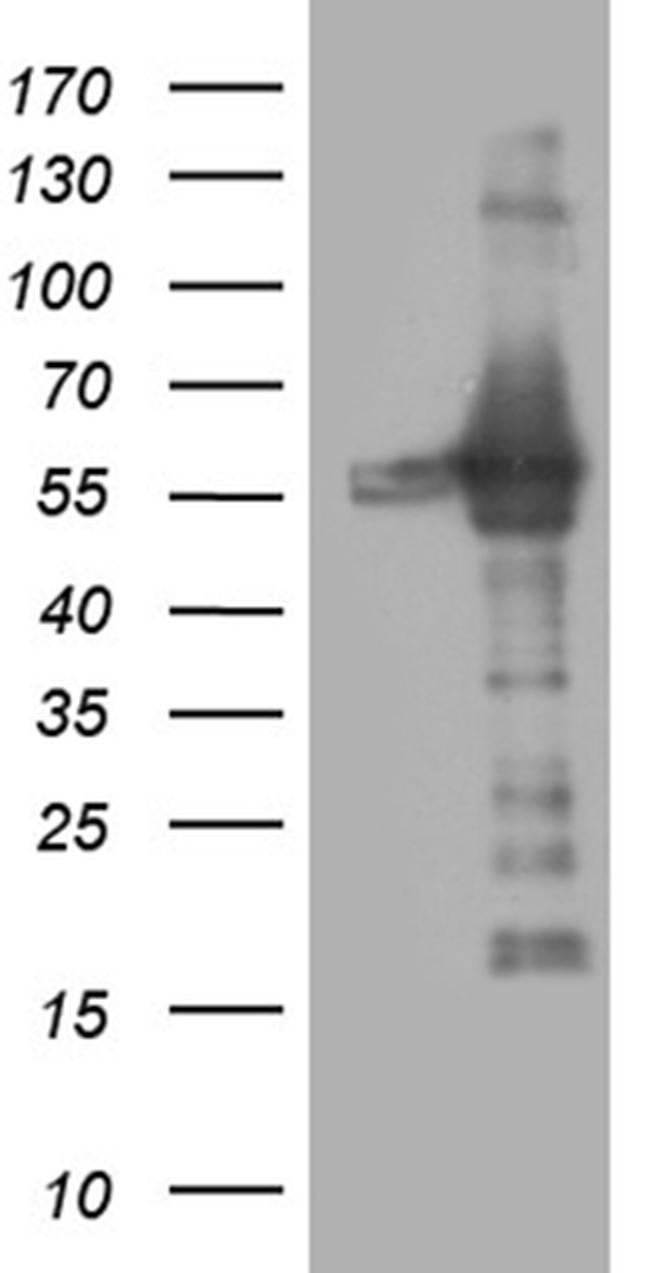 RING1 Antibody in Western Blot (WB)