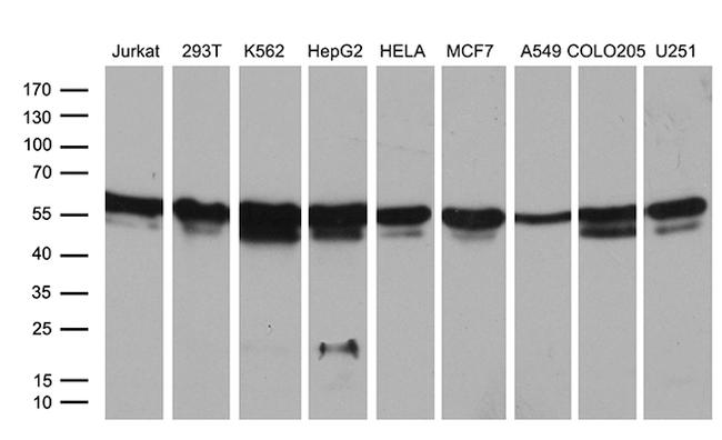 RING1 Antibody in Western Blot (WB)