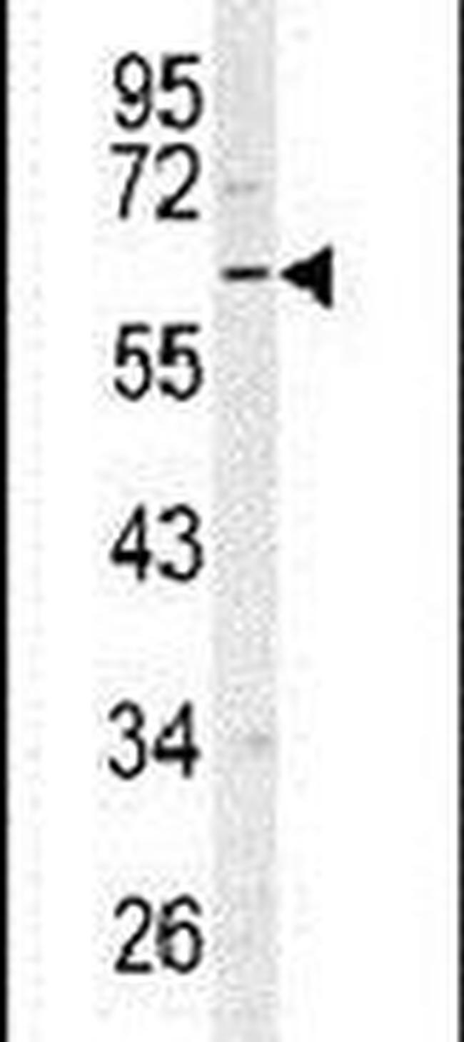 RIP3 Antibody in Western Blot (WB)