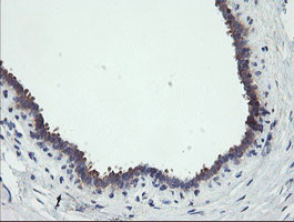 RIPK1 Antibody in Immunohistochemistry (Paraffin) (IHC (P))