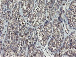 RIPK1 Antibody in Immunohistochemistry (Paraffin) (IHC (P))