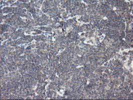 RIPK1 Antibody in Immunohistochemistry (Paraffin) (IHC (P))