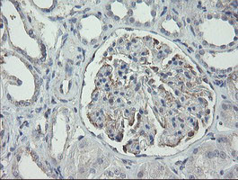 RIPK1 Antibody in Immunohistochemistry (Paraffin) (IHC (P))