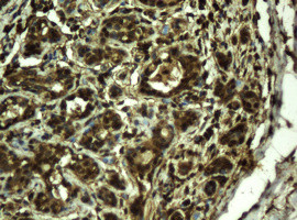 RIPK1 Antibody in Immunohistochemistry (Paraffin) (IHC (P))