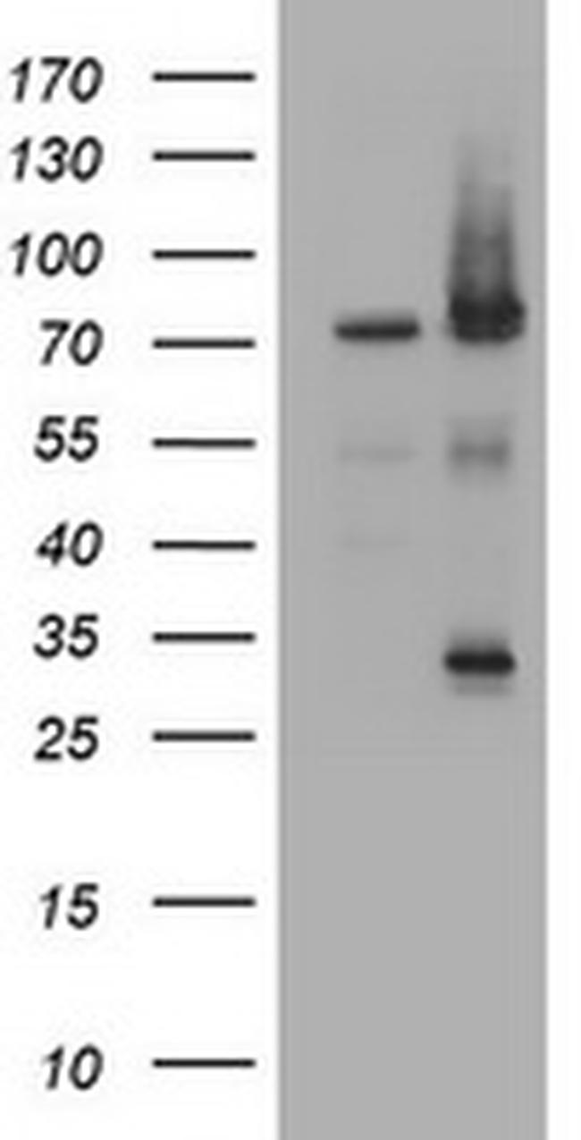 RIPK1 Antibody in Western Blot (WB)