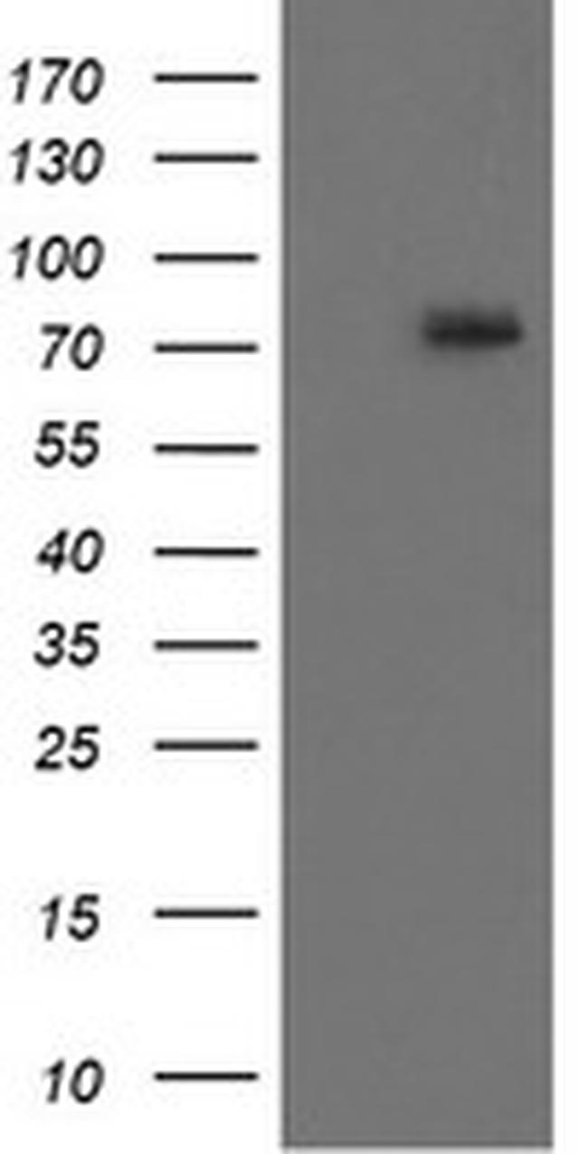 RIPK1 Antibody in Western Blot (WB)