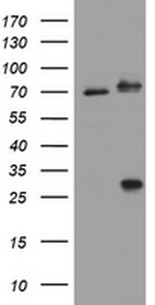 RIPK1 Antibody in Western Blot (WB)