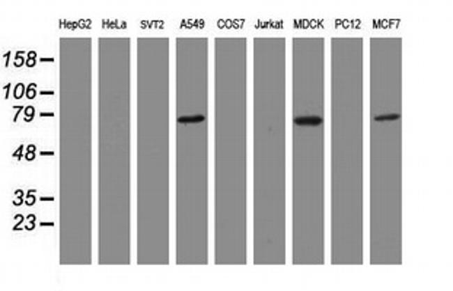 RIPK1 Antibody in Western Blot (WB)