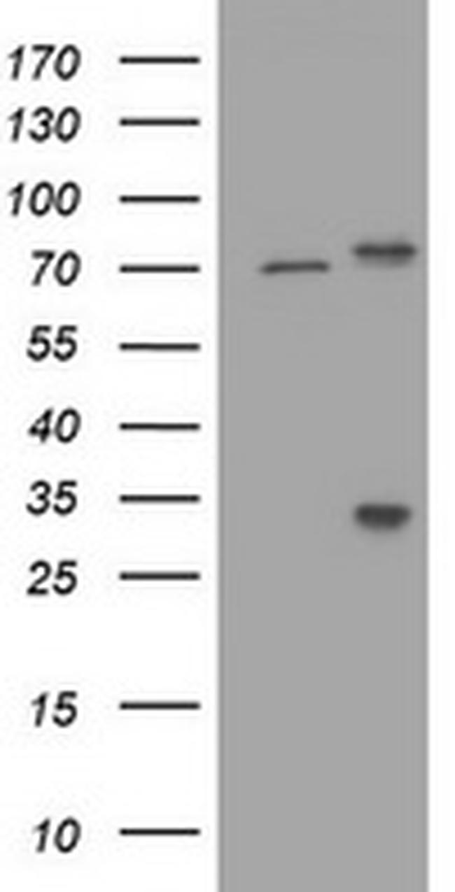 RIPK1 Antibody in Western Blot (WB)