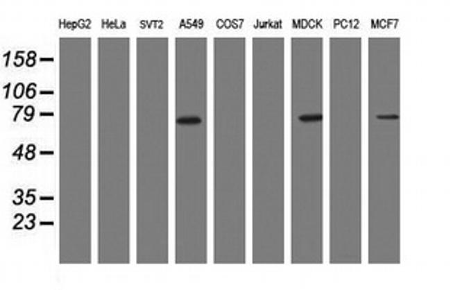 RIPK1 Antibody in Western Blot (WB)