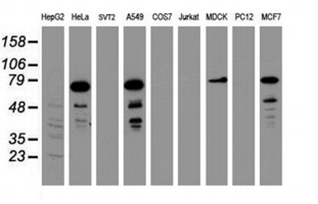 RIPK1 Antibody in Western Blot (WB)