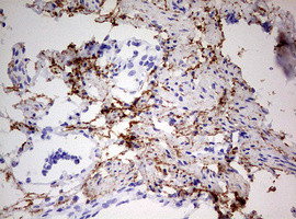 RIPK3 Antibody in Immunohistochemistry (Paraffin) (IHC (P))