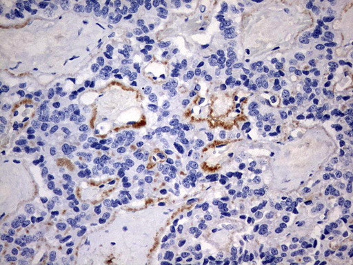 RIPK3 Antibody in Immunohistochemistry (Paraffin) (IHC (P))