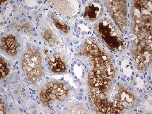 RIPK3 Antibody in Immunohistochemistry (Paraffin) (IHC (P))