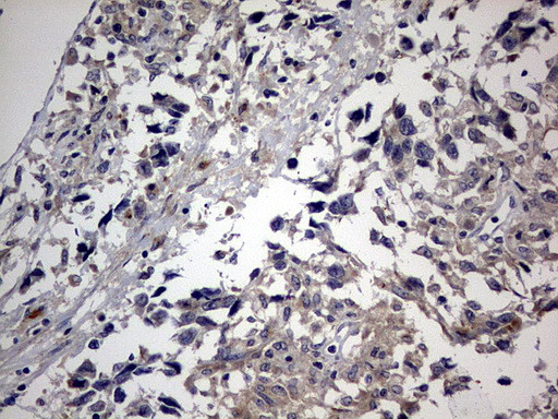 RIPK3 Antibody in Immunohistochemistry (Paraffin) (IHC (P))