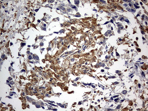 RIPK3 Antibody in Immunohistochemistry (Paraffin) (IHC (P))