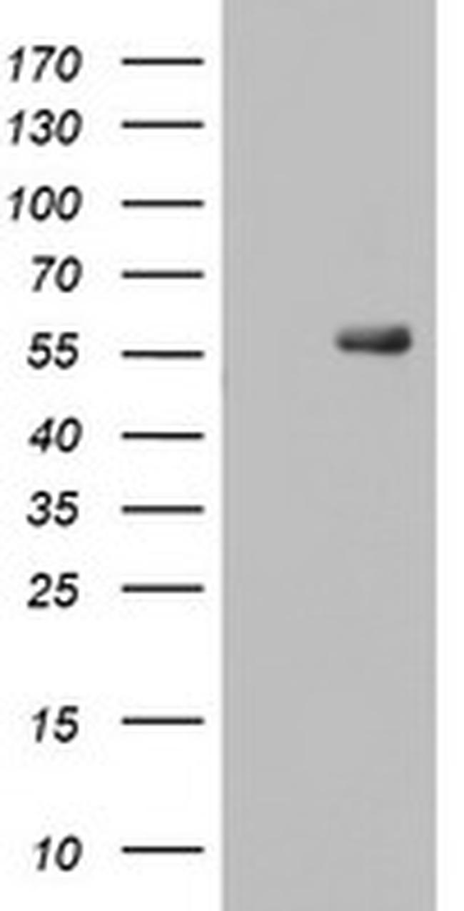 RIPK3 Antibody in Western Blot (WB)