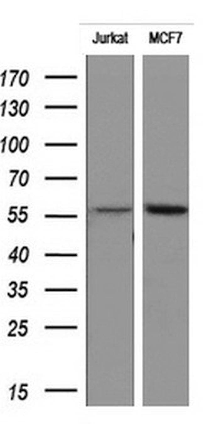 RIPK3 Antibody in Western Blot (WB)