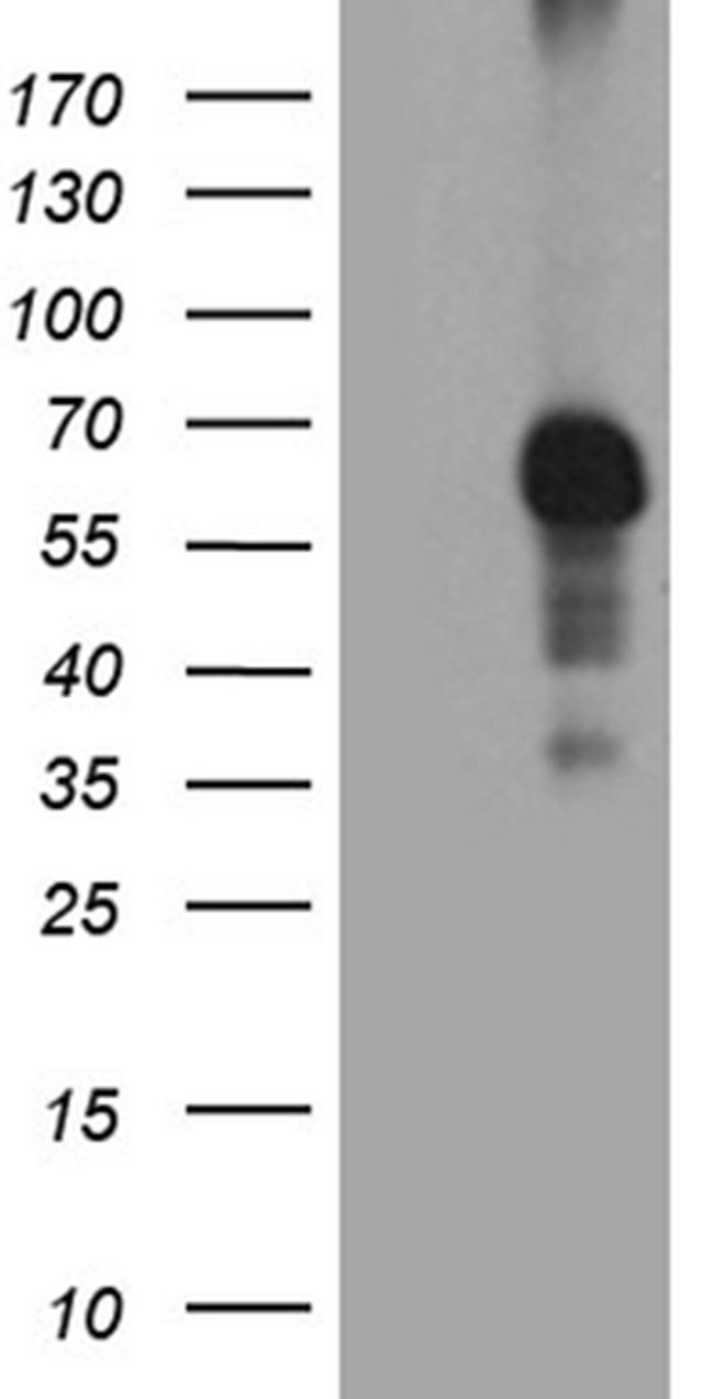 RIPK3 Antibody in Western Blot (WB)