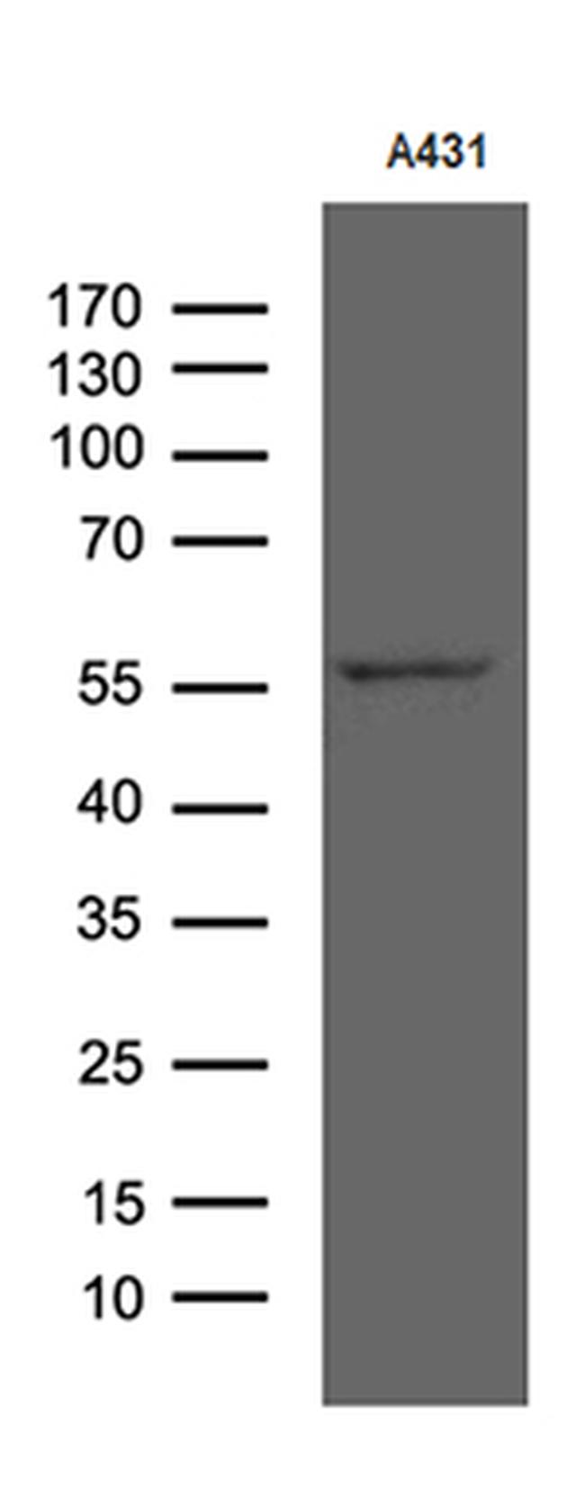 RIPK3 Antibody in Western Blot (WB)