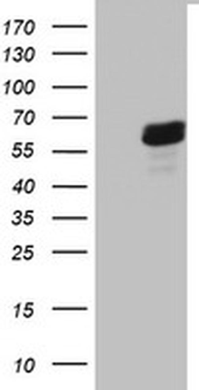 RIPK3 Antibody in Western Blot (WB)