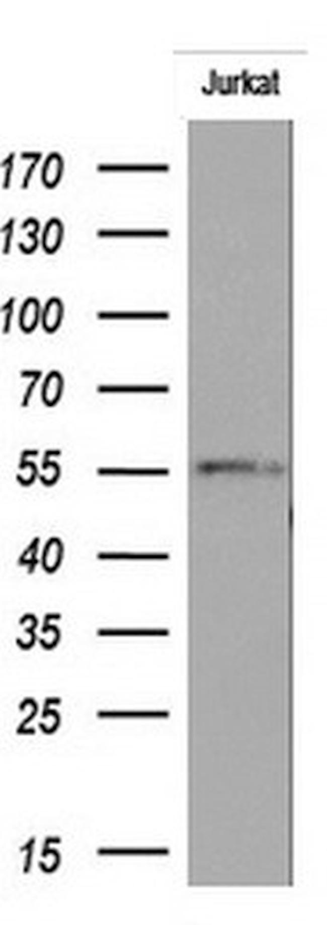 RIPK3 Antibody in Western Blot (WB)