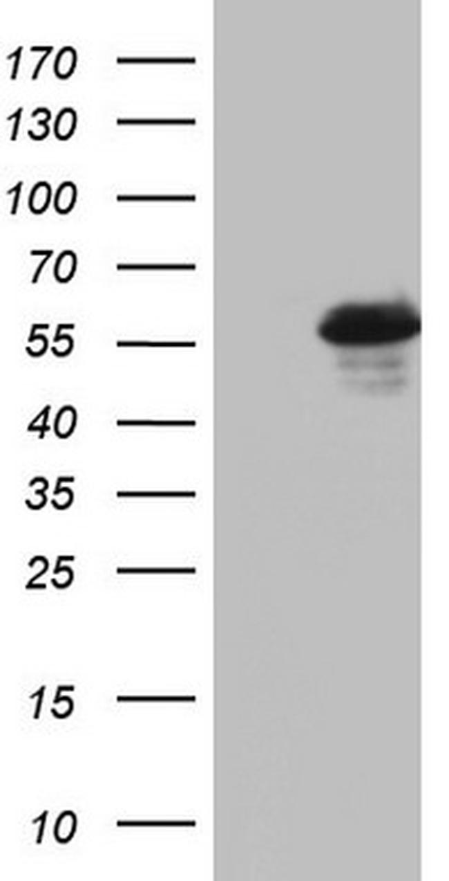 RIPK3 Antibody in Western Blot (WB)