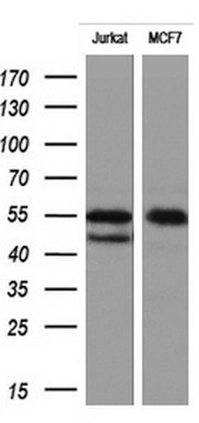 RIPK3 Antibody in Western Blot (WB)