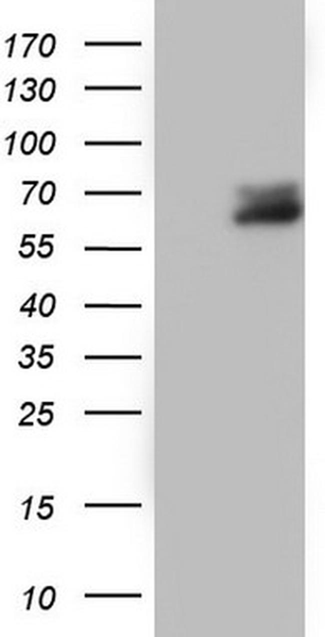 RIPK3 Antibody in Western Blot (WB)