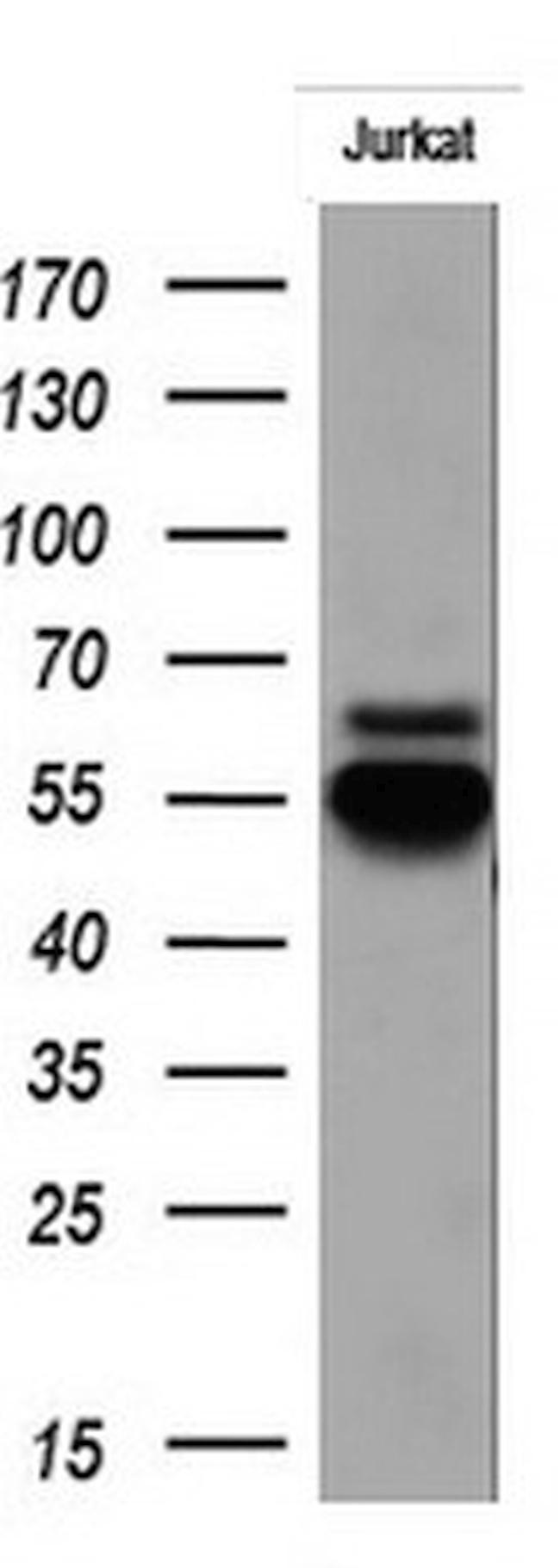 RIPK3 Antibody in Western Blot (WB)