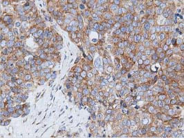 RIT2 Antibody in Immunohistochemistry (Paraffin) (IHC (P))