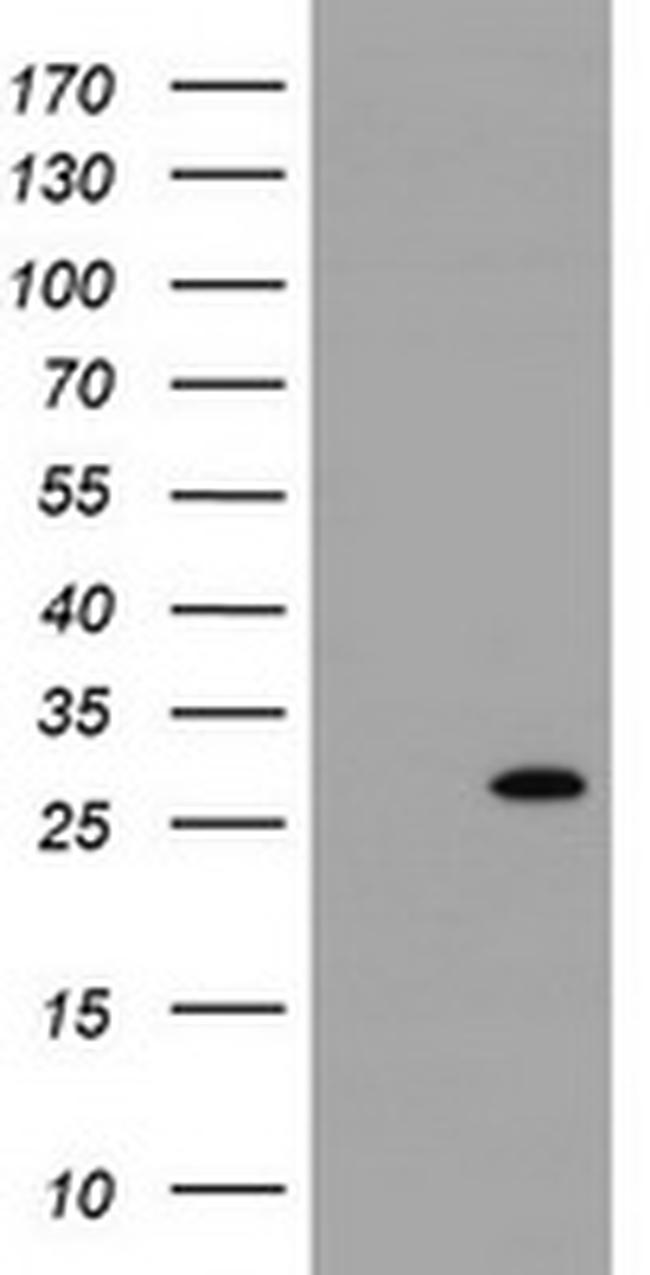 RIT2 Antibody in Western Blot (WB)