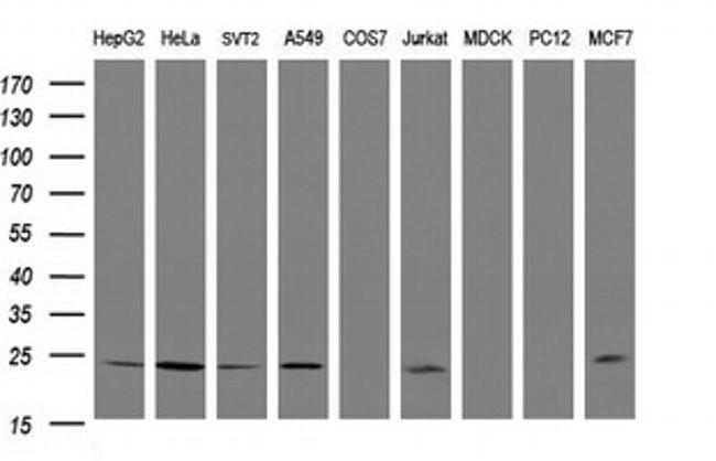 RIT2 Antibody in Western Blot (WB)