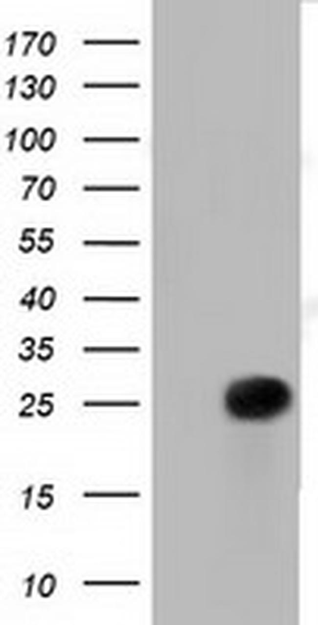 RIT2 Antibody in Western Blot (WB)