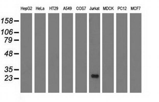 RIT2 Antibody in Western Blot (WB)