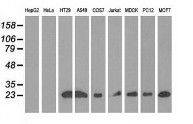 RIT2 Antibody in Western Blot (WB)