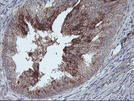 RLBP1 Antibody in Immunohistochemistry (Paraffin) (IHC (P))