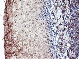 RLBP1 Antibody in Immunohistochemistry (Paraffin) (IHC (P))