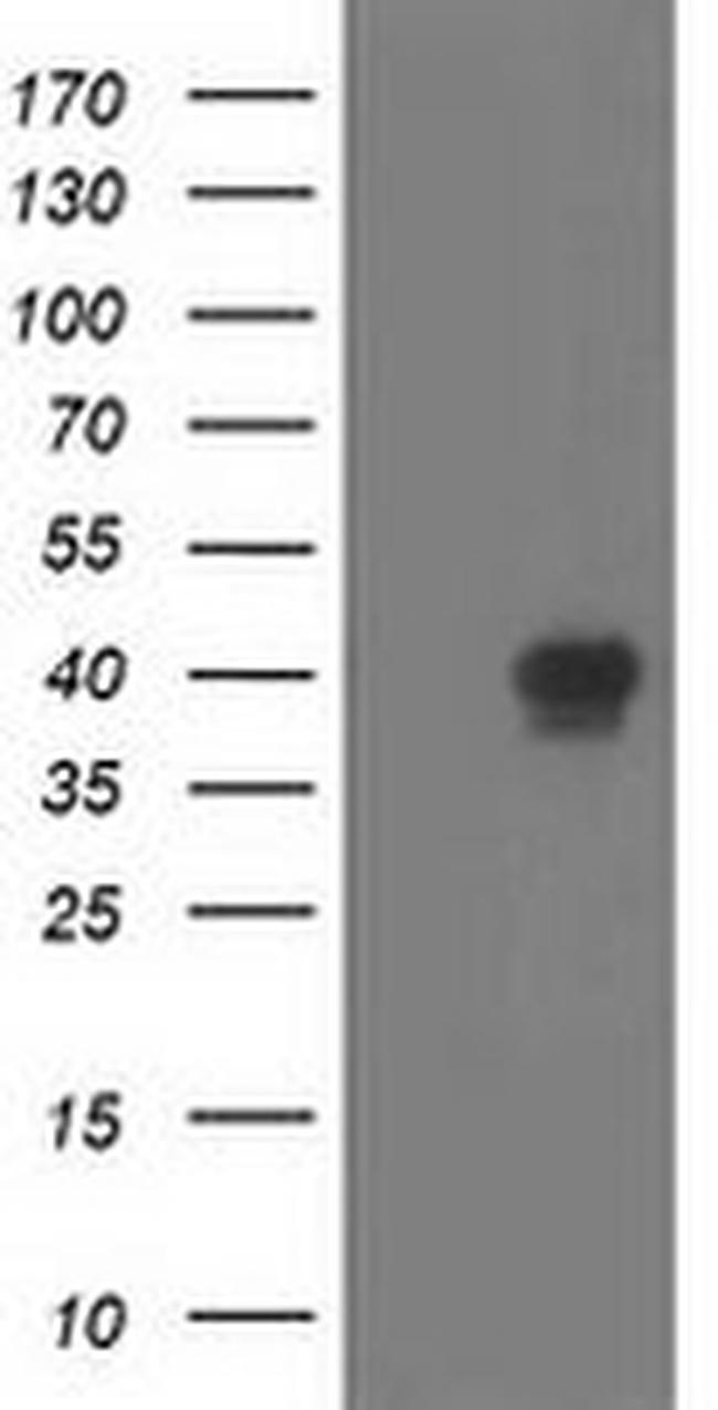 RLBP1 Antibody in Western Blot (WB)