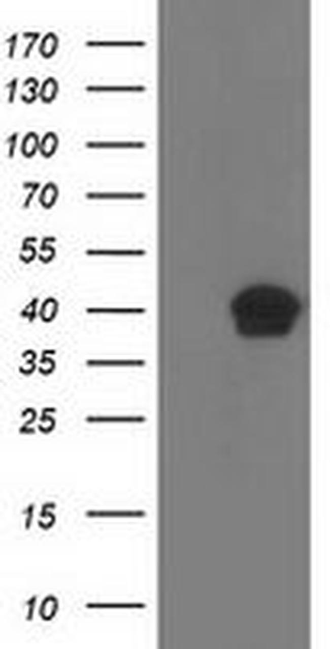 RLBP1 Antibody in Western Blot (WB)