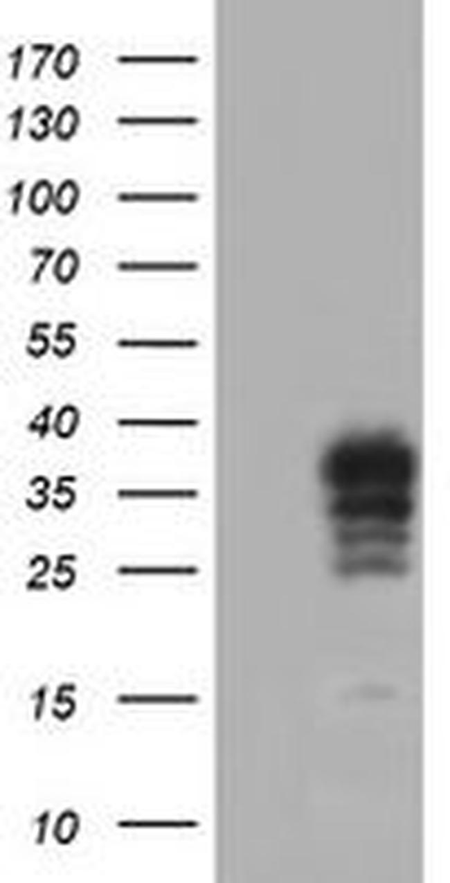 RLBP1 Antibody in Western Blot (WB)