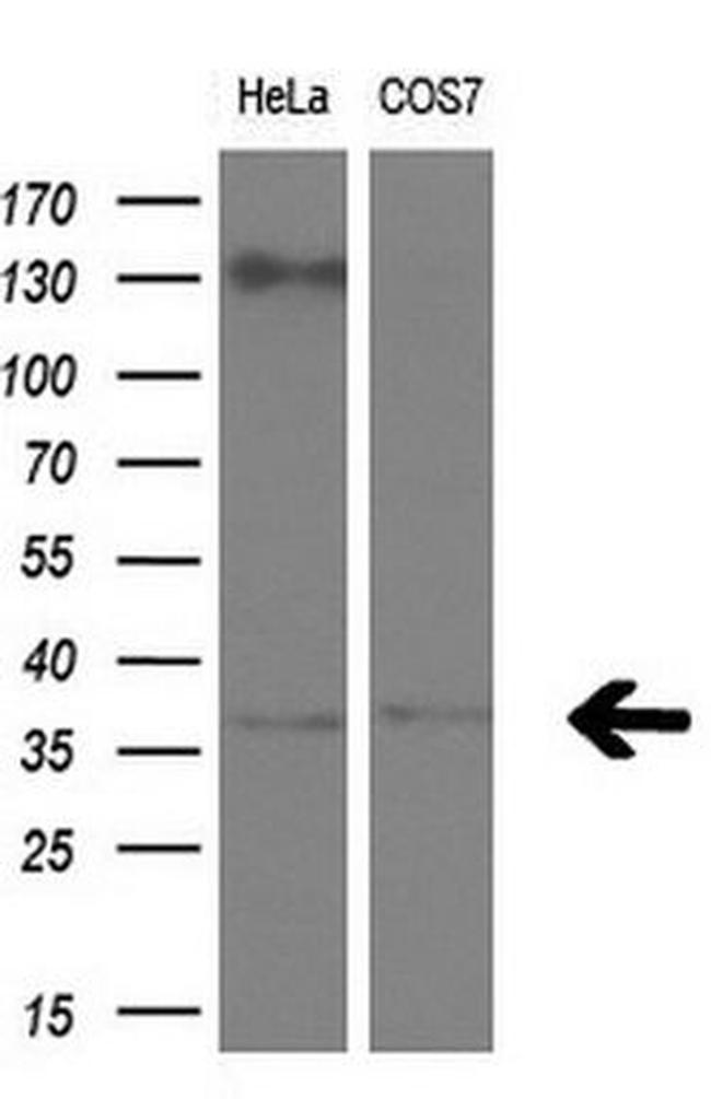 RLBP1 Antibody in Western Blot (WB)