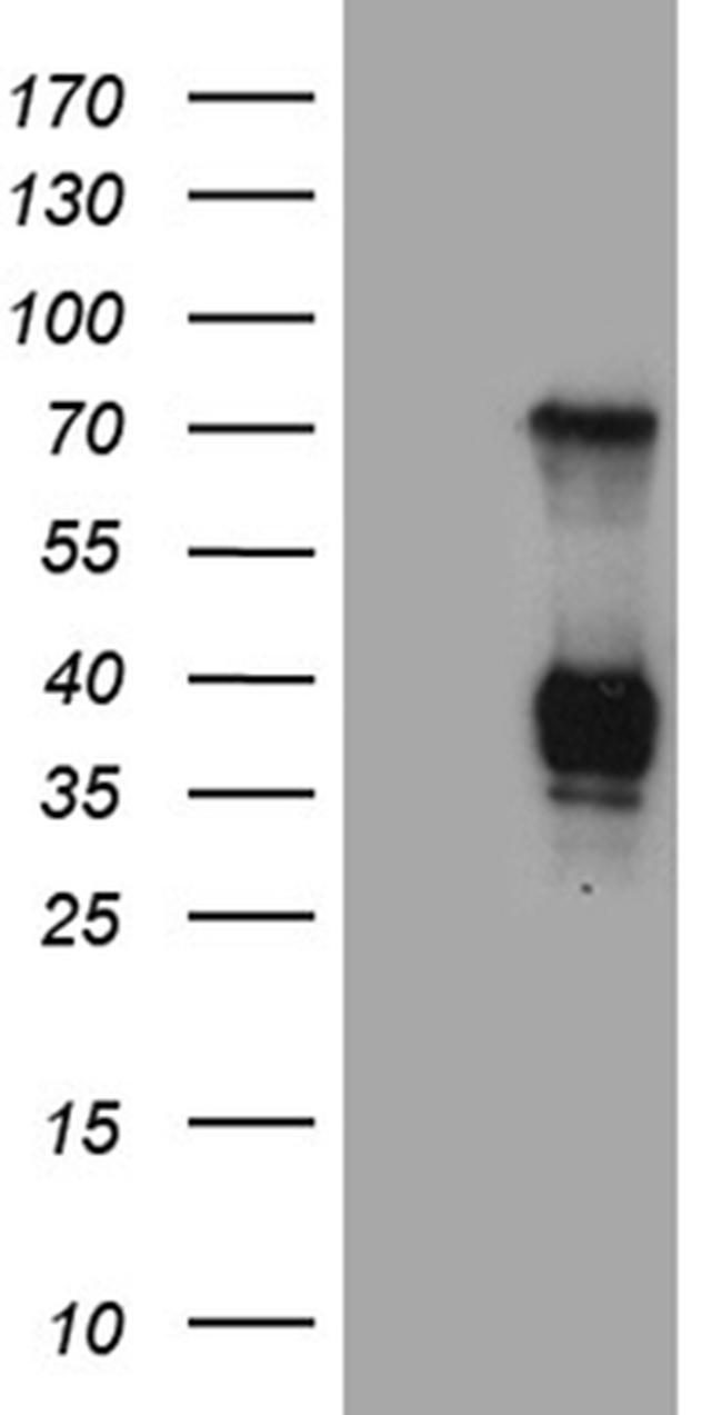 RNASE11 Antibody in Western Blot (WB)