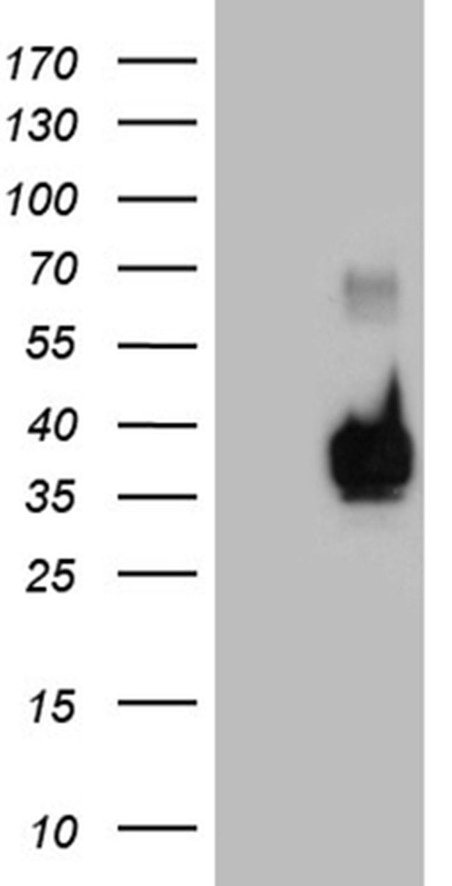 RNASE11 Antibody in Western Blot (WB)