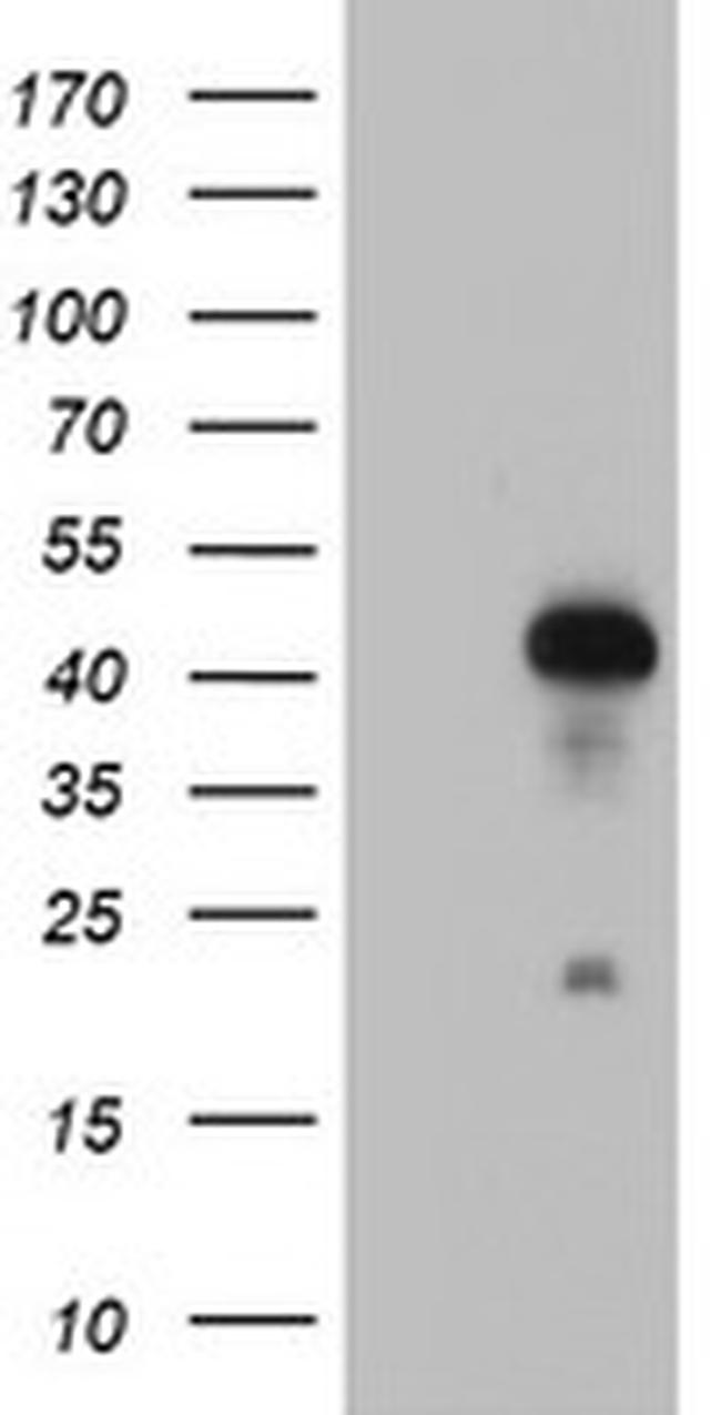 RNF113B Antibody in Western Blot (WB)