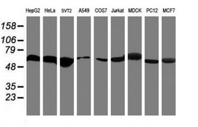 RNF113B Antibody in Western Blot (WB)