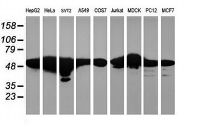 RNF113B Antibody in Western Blot (WB)